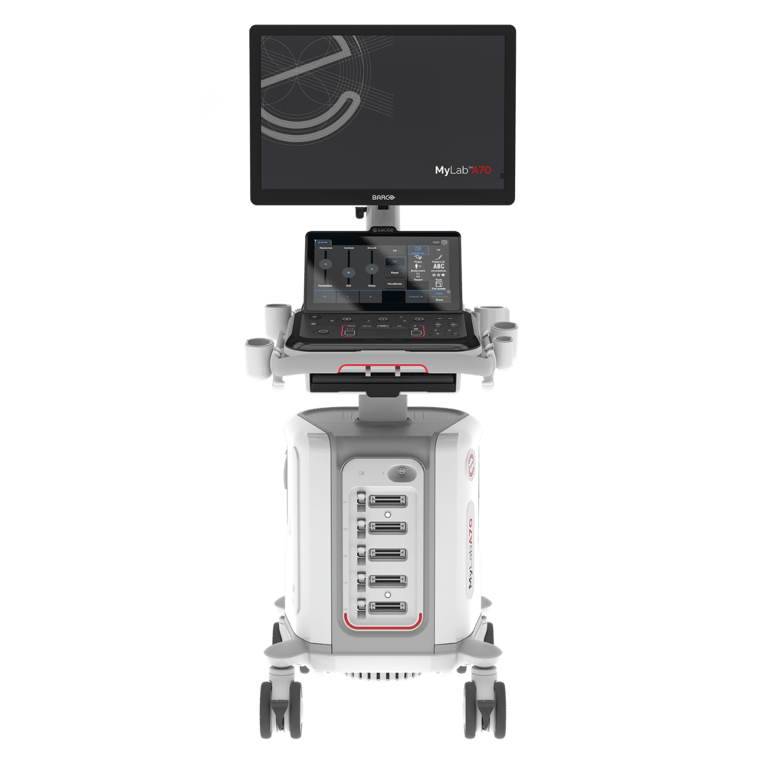 Esaote MyLab A70