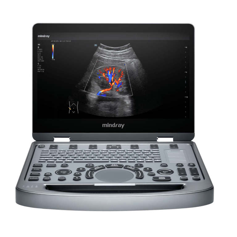 Mindray MX3